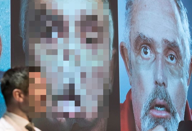 Обезображенный 64-летний канадец получил новое лицо (3 фото)