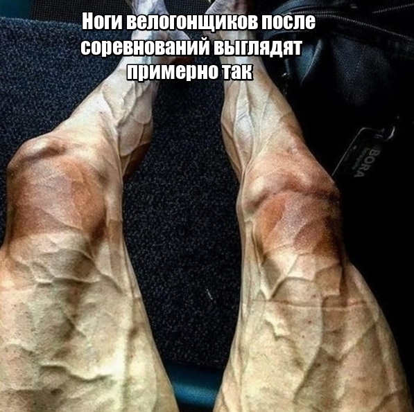 Обратная сторона побед в профессиональном спорте (12 фото)
